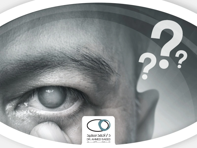 اسباب-المياه-البيضاء-في-العين أسباب المياه البيضاء في العين