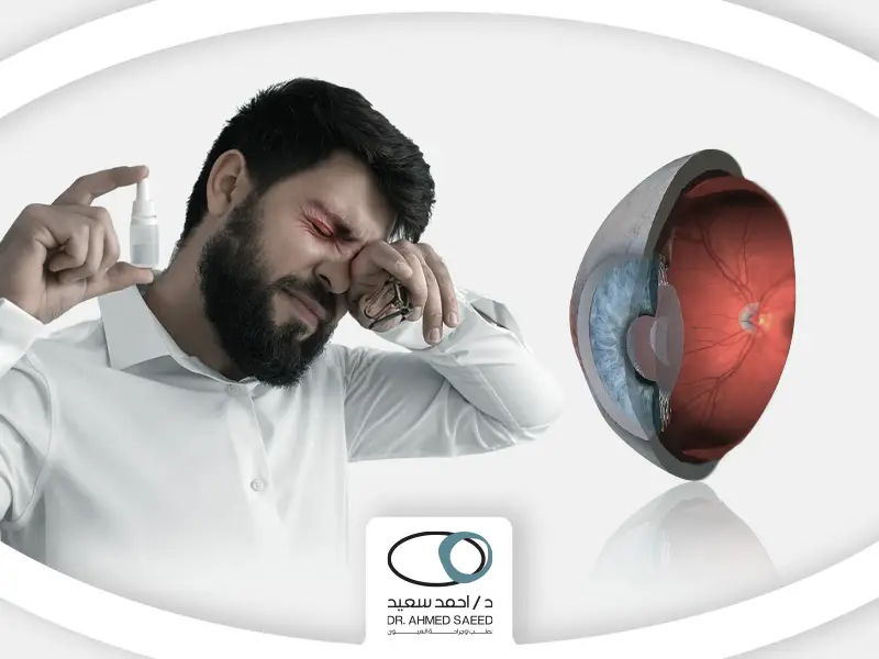 علاج التهاب العصب البصري